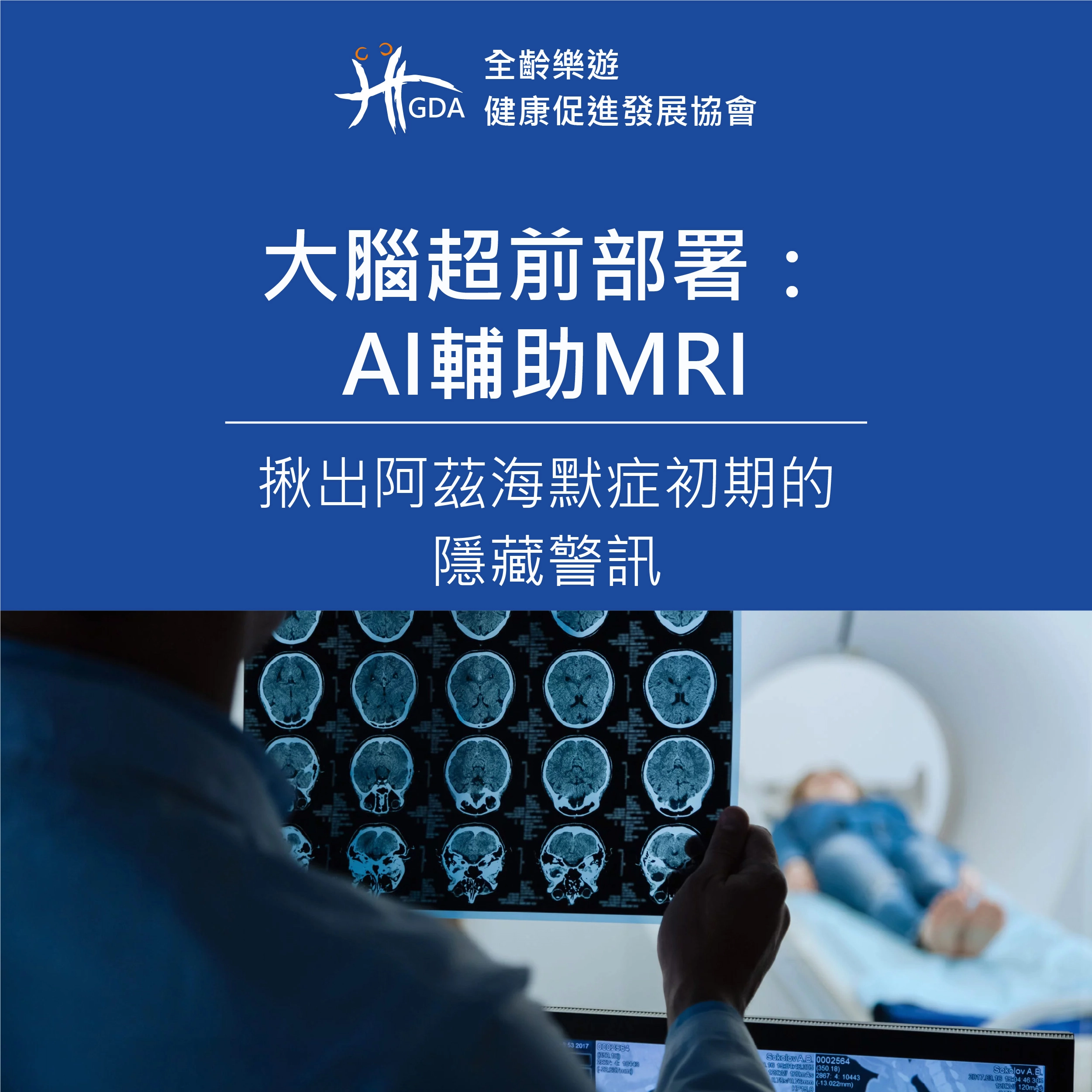 阿茲海默症初期會有的隱藏訊息，透過MRI與科技輔助來發現!