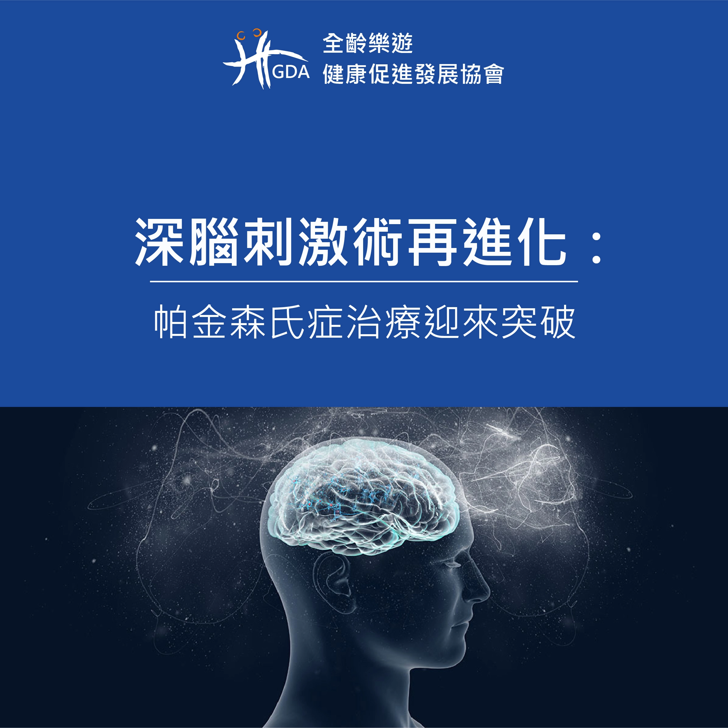 深腦刺激術再進化：帕金森氏症治療迎來突破